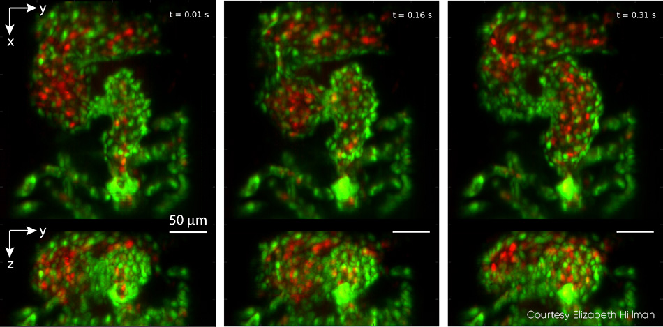 Zebrafish Heart Beating in Real-time Captured at 100 vps