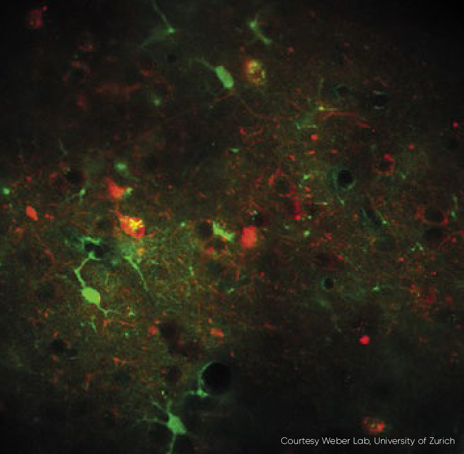 High Contrast, Fast Frame Rate Calcium Imaging