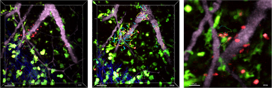 washington-university-t-cell-antigen.jpg