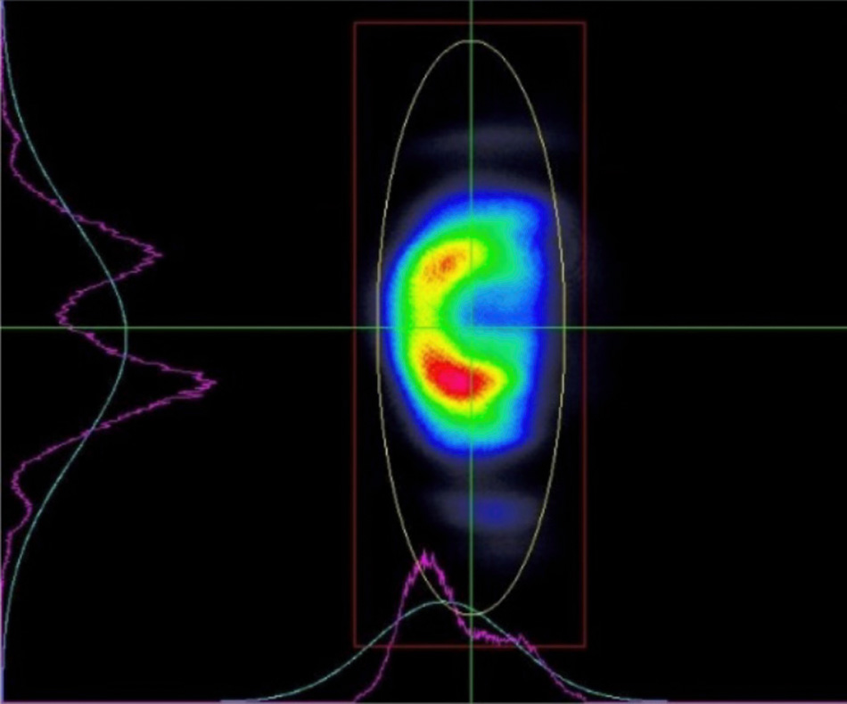 Large M2 Causes Focused Intensity Pattern with Gross Irregularities