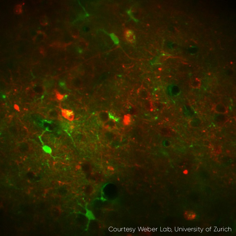 Kalzium-Imaging mit hohem Kontrast und schneller Bildrate