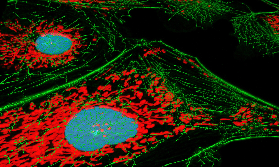 LASERANGEREGTE FLUORESZENZ