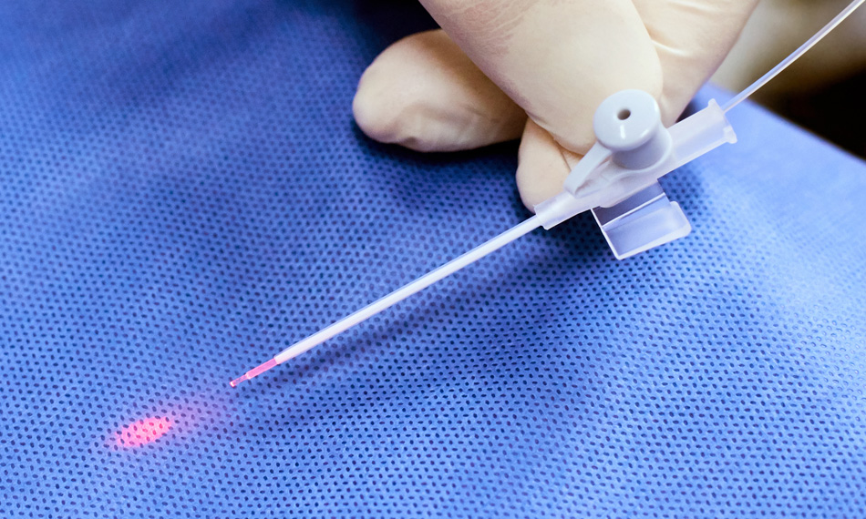 Varicose Vein Laser Treatment