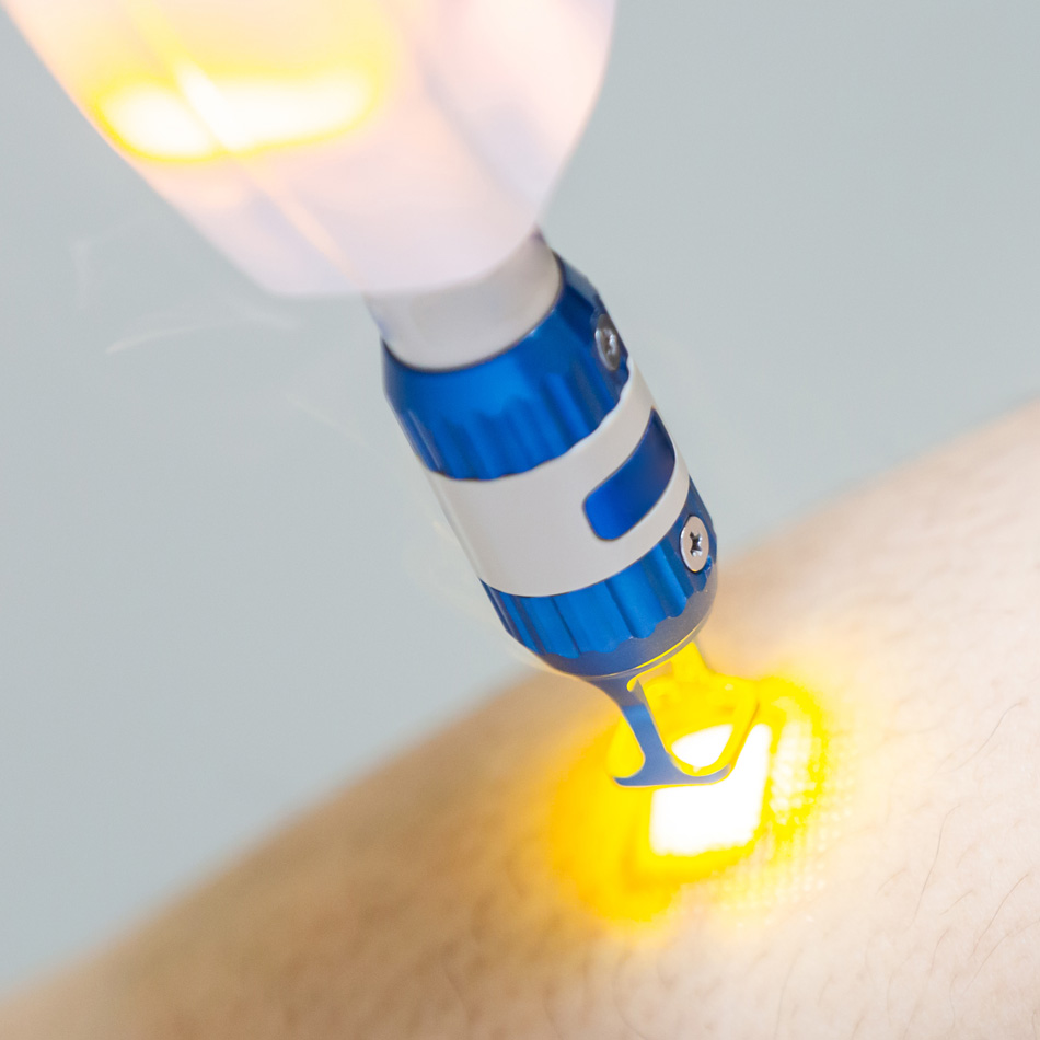 Laser für Dermatologie und Ästhetik