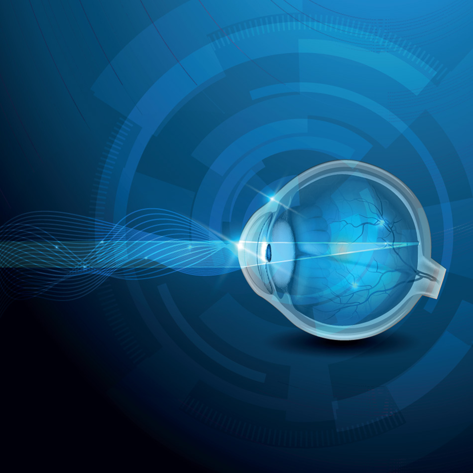 Retinal Photocoagulation