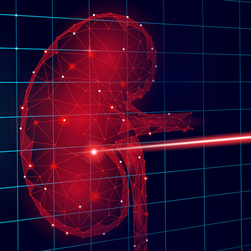 Laser für die Urologie
