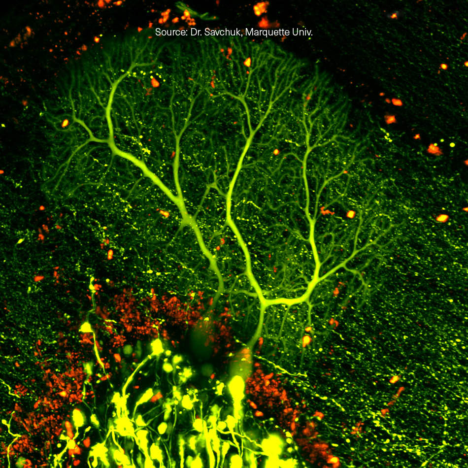 MPE Microscopy